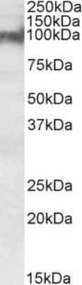 Western Blot: Plakophilin 2 Antibody [NBP1-72054]