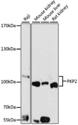 Western Blot: Plakophilin 2 AntibodyBSA Free [NBP2-94257]