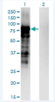 Western Blot: Plakophilin-3 Antibody (6E5) [H00011187-M04-100ug]
