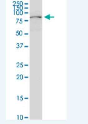 Western Blot: Plakophilin-3 Antibody (6E5) [H00011187-M04-100ug]