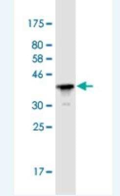 Western Blot: Plakophilin-3 Antibody (6E5) [H00011187-M04-100ug]