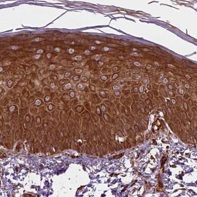Immunohistochemistry-Paraffin: Plakophilin-3 Antibody [NBP2-49379]