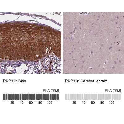 Immunohistochemistry-Paraffin: Plakophilin-3 Antibody [NBP2-49379]