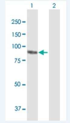 Western Blot: Plakophilin-3 Antibody [H00011187-B01P-50ug]