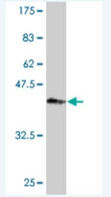 Western Blot: Plakophilin 4 Antibody (1B2) [H00008502-M01]