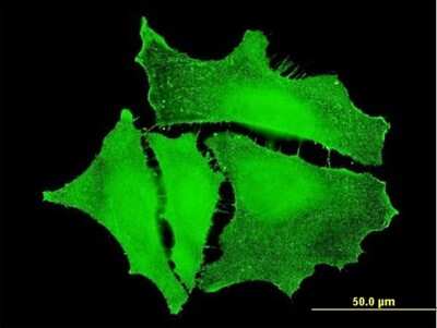 Immunocytochemistry/ Immunofluorescence: Plakophilin 4 Antibody (4H7) [H00008502-M06]