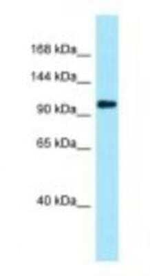 Western Blot: Plakophilin 4 Antibody [NBP1-98523]