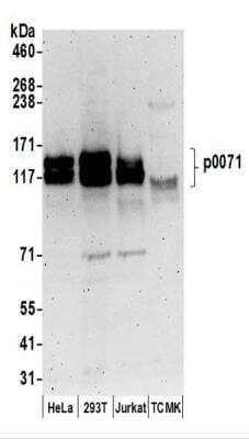 Western Blot: Plakophilin 4 Antibody [NBP2-37691]