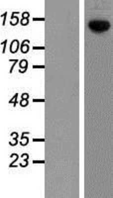 Western Blot: Plakophilin 4 Overexpression Lysate [NBP2-10602]