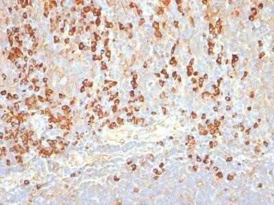 Immunohistochemistry-Paraffin: Plasma Cell Antibody (LIV3G11 (7B18)) - IHC-Prediluted [NBP2-45189]