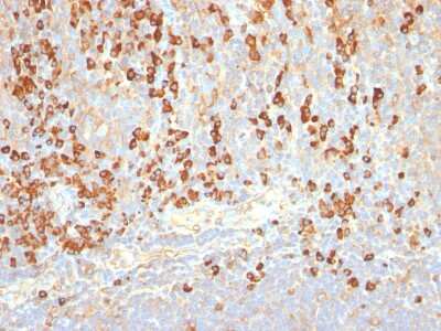 Immunohistochemistry-Paraffin: Plasma Cell Marker Antibody (SPM310) - Azide and BSA Free [NBP2-34407]