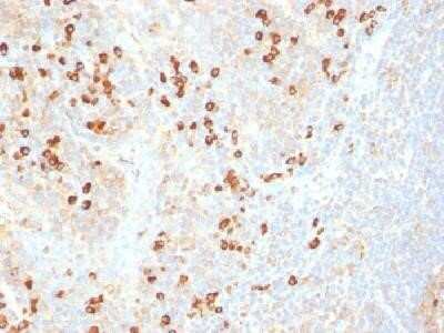 Immunohistochemistry-Paraffin: Plasma Cell Marker Antibody (SPM310) - Azide and BSA Free [NBP2-34407]