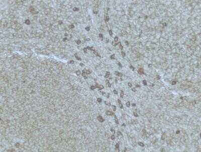 Immunohistochemistry-Paraffin: Plasma Cell Marker Antibody (SPM310) - IHC-Prediluted [NBP2-45200]