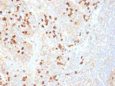 Immunohistochemistry-Paraffin: Plasma Cell Marker Antibody (SPM310) - IHC-Prediluted [NBP2-45200]