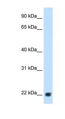 Western Blot: Plasma Kallikrein/KLKB1 Antibody [NBP1-58978]