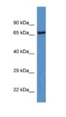 Western Blot: Plasma Kallikrein/KLKB1 Antibody [NBP1-74210]