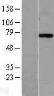 Western Blot: Plasma Kallikrein/KLKB1 Overexpression Lysate [NBL1-12359]