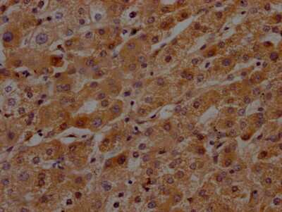 Immunohistochemistry: Plasma Kallikrein/KLKB1 Antibody (9F6) [NBP3-15209]