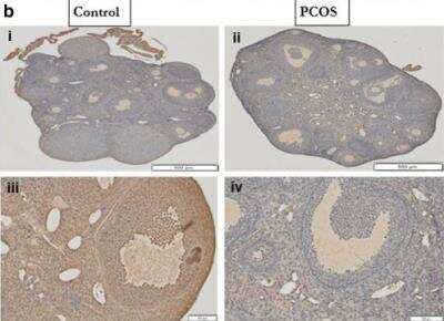 Immunohistochemistry: Plasminogen Antibody [NB300-544]