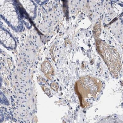 Immunohistochemistry: Plasminogen Antibody [NBP1-86015]