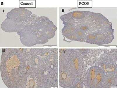 Immunohistochemistry: Plasminogen Antibody [NBP2-19859]