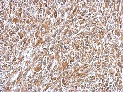 Immunohistochemistry-Paraffin: Plasminogen Antibody [NBP2-19859]