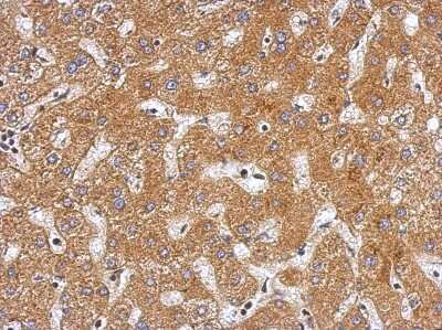 Immunohistochemistry-Paraffin: Plasminogen Antibody [NBP2-19859]