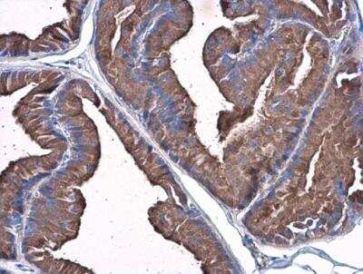 Immunohistochemistry-Paraffin: Plasminogen Antibody [NBP2-19859]