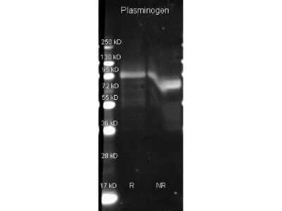 Western Blot: Plasminogen Antibody [NB600-930]