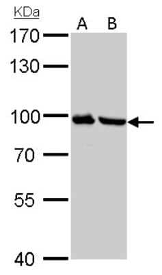 Western Blot: Plasminogen Antibody [NBP2-19859]