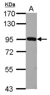 Western Blot: Plasminogen Antibody [NBP2-19859]