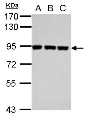 Western Blot: Plasminogen Antibody [NBP2-19859]