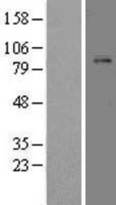 Western Blot: Plasminogen Overexpression Lysate [NBL1-14513]