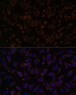 Immunocytochemistry/ Immunofluorescence: Plasmolipin Antibody - Azide and BSA Free [NBP2-94002]