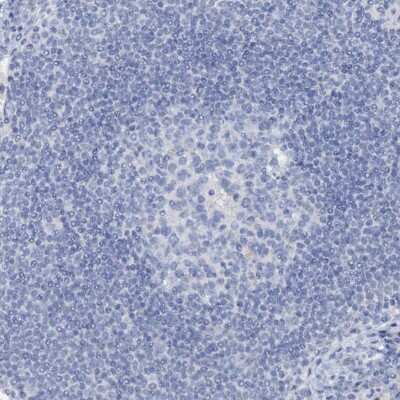 Immunohistochemistry-Paraffin: Plasmolipin Antibody [NBP2-13777]