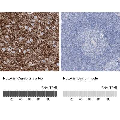 Immunohistochemistry-Paraffin: Plasmolipin Antibody [NBP2-13777]