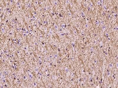 Immunohistochemistry-Paraffin: Plasmolipin Antibody [NBP2-97387]