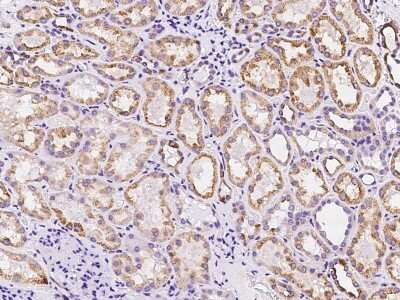 Immunohistochemistry-Paraffin: Plasmolipin Antibody [NBP2-97387]