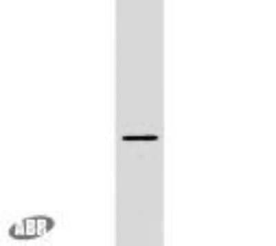 Western Blot: Plasmolipin Antibody [NBP2-22465]