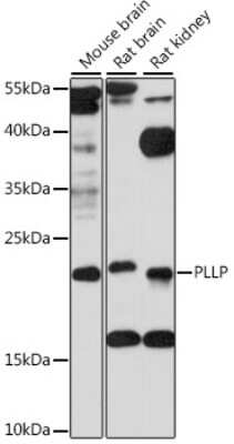 Western Blot: Plasmolipin AntibodyAzide and BSA Free [NBP2-94002]