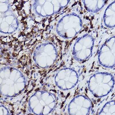Immunohistochemistry-Paraffin: Plastin L Antibody (3T0M1) [NBP3-16459]