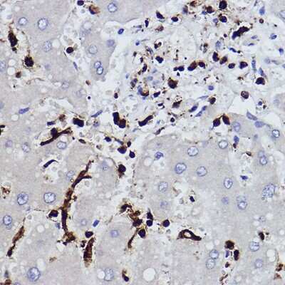 Immunohistochemistry-Paraffin: Plastin L Antibody (3T0M1) [NBP3-16459]