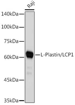 Western Blot: Plastin L Antibody (3T0M1) [NBP3-16459]