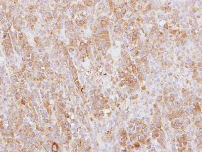 Immunohistochemistry-Paraffin: Plastin L Antibody [NBP2-19861]