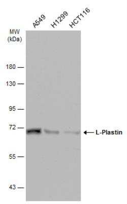 Western Blot: Plastin L Antibody [NBP2-19860]