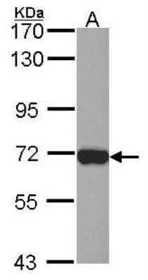 Western Blot: Plastin L Antibody [NBP2-19861]