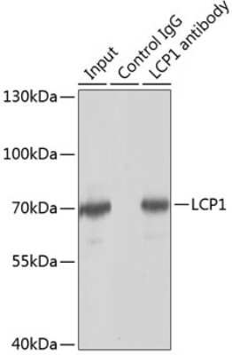 Western Blot: Plastin L AntibodyAzide and BSA Free [NBP2-94267]