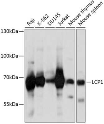 Western Blot: Plastin L AntibodyAzide and BSA Free [NBP2-94267]
