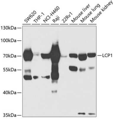 Western Blot: Plastin L AntibodyBSA Free [NBP2-95139]