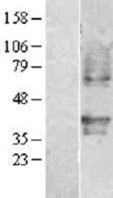 Western Blot: PAFR Overexpression Lysate [NBL1-14916]